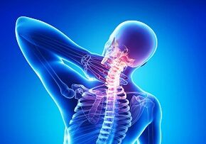 Verjetni zapleti s stičiščem osteohondroze