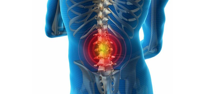 metode za diagnosticiranje bolečine v hrbtu